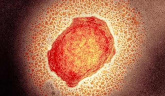 两周内感染人数翻一番，荷兰猴痘病毒感染者进一步增加，累计破500人